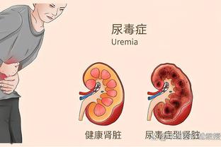 双红会相互战绩：曼联近7场2胜1平4负